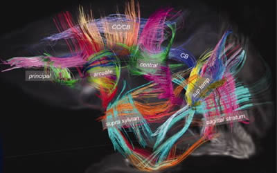 ปัญญาความคิด